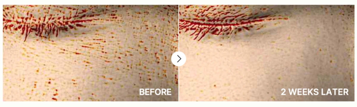 Products to improve pores