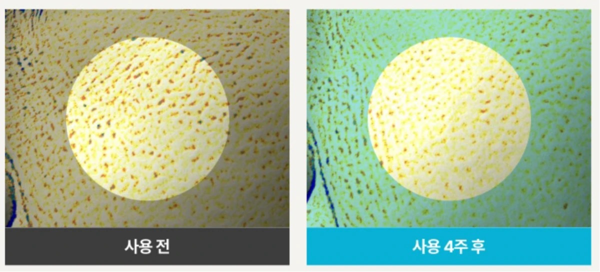 Products to improve pores